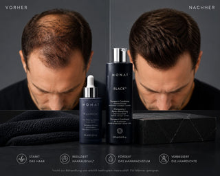 MONAT Haarwachstum Set – Shampoo & Kopfhautserum für Frauen und Männer