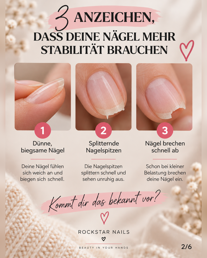 Drei Anzeichen für dünne und brüchige Nägel – Rockstar Nails Fiberglas-Gel-Ratgeber